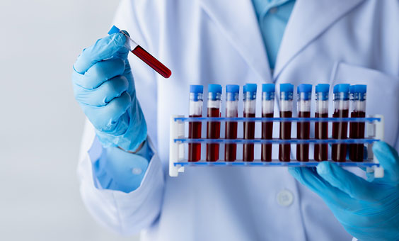 Blood Bank and Transfusion Medicine 